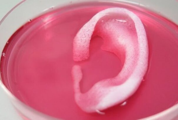 Csont-, izom- és porcdarabokat nyomtattak 3D-ben amerikai orvosok