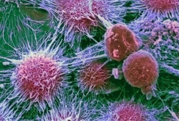 Új éra küszöbén állunk a rák gyógyításában?