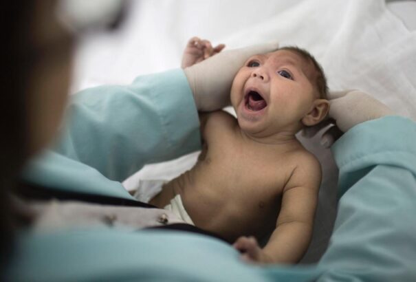 Megszületett az első Zika-vírusos csecsemő az USA-ban