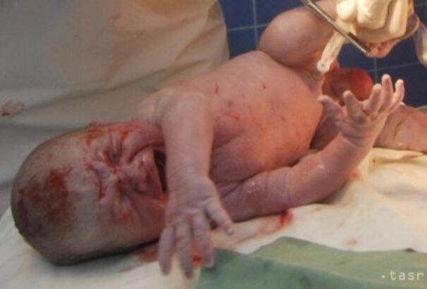 Rohamosan növekszik a „császármetszéses” szülések száma Szlovákiában