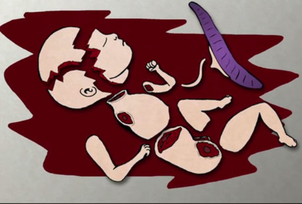 Lengyelország teljesen betiltaná az abortuszt