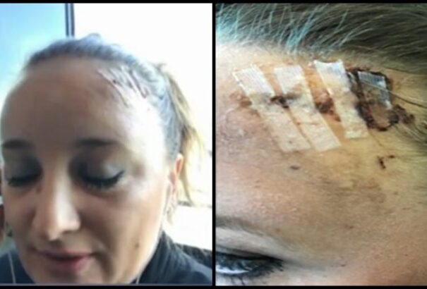 Brutálisan megvertek egy magyar nőt szomáliai szomszédai Londonban