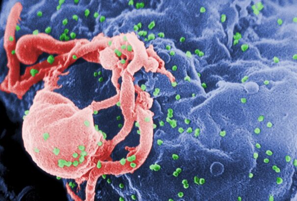 Nő a HIV-fertőzöttek száma Szlovákiában