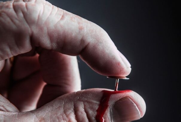 Leharapta a nyelvét, mégsem érzett fájdalmat. A CIP-es beteg szerint fájdalom nélkül élni átok, nem áldás