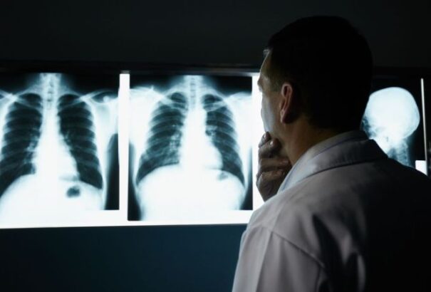 Marcel Klimek: Smeres Abszurdisztán