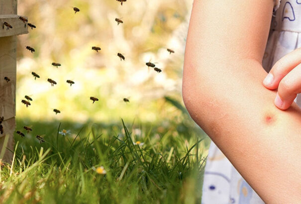 Csípések, hólyagok, fullánkok. Ezek a rovarok leselkednek ránk a nyári aktivitásaink során