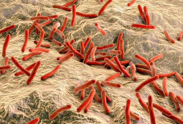 Míg 1918-ban többen haltak meg TBC-ben és influenzában, ma szívbetegségben