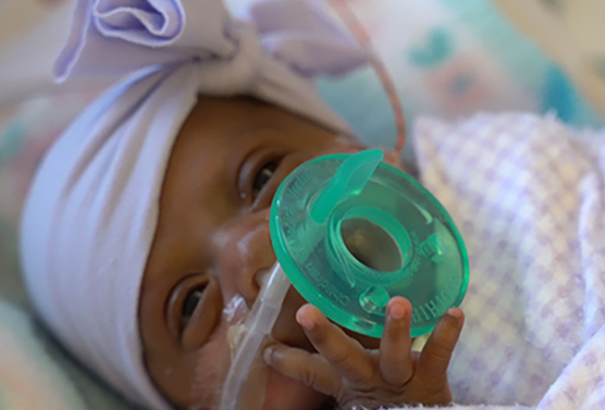 Megszületett a világ legkisebb gyermeke. A súlya egy nagyobb almáéval vetekedett