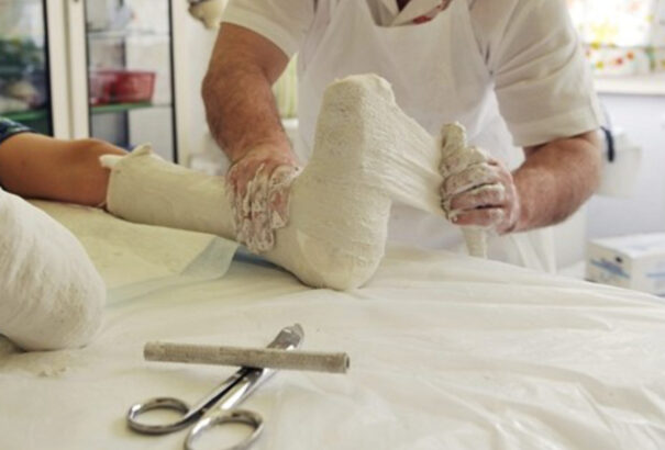 Szakértő: gyakoribbak a sérülések nyaralás közben