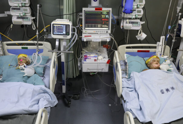 Még évekig eltarthat a szétválasztott bangladesi sziámi ikrek rehabilitációja