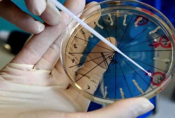 Felrobbant egy feketehimlőt és ebolát raktározó orosz labor