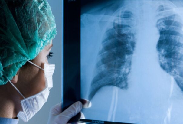 Komáromban az év végével megszűnik a tüdőgyógyászati járóbetegellátás