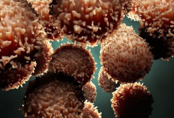 Korszakalkotó tanulmány változtathatja meg a daganatos betegségek kezelését