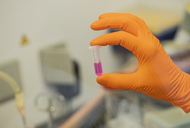 A tudósoknak sikerült izolálniuk az új típusú koronavírus első szlovákiai törzseit