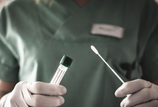 Az elmúlt 24 óra mérlege Szlovákiában: 1302 teszt, 66 új fertőzött