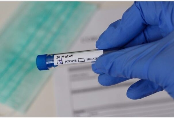 Csütörtöki mérleg Szlovákiában: több mint ötezer teszt mellett hét fertőzöttet regisztráltak