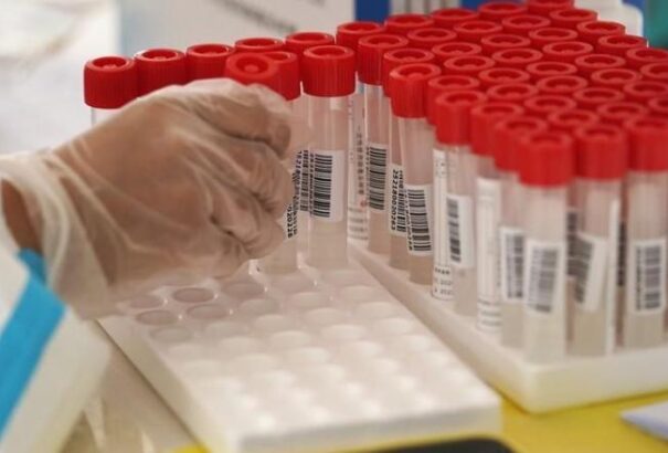 Koronavírus Szlovákiában: 2 482 tesztelés, 53 új fertőzött