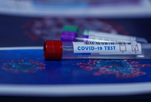 A szlovákiai polgároknak negatív koronavírus-tesztet kell felmutatniuk Ukrajnában