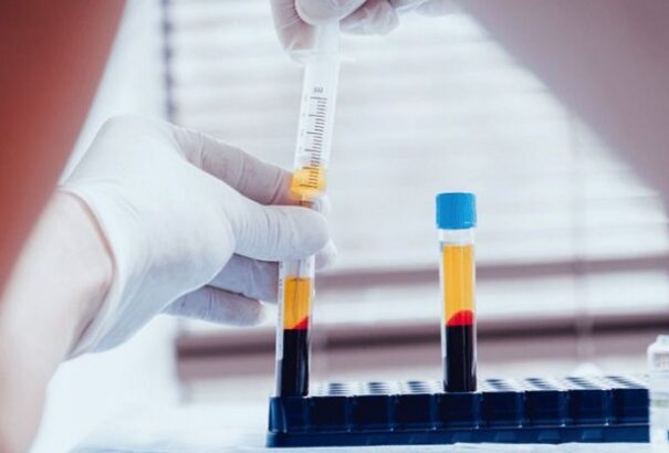 Magyarországon tizenöttel nőtt a fertőzöttek száma