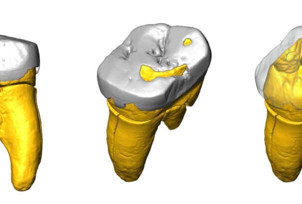 Neandervölgyi DNS-re bukkantak egy ősi fogban