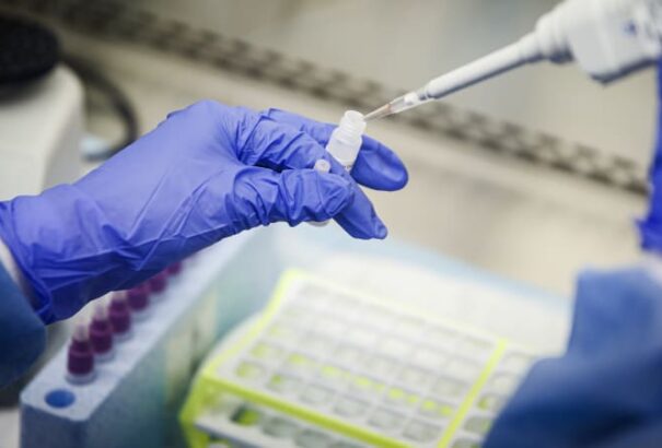 Most már biztos, hogy Csehországban is megjelent a dél-afrikai mutáció