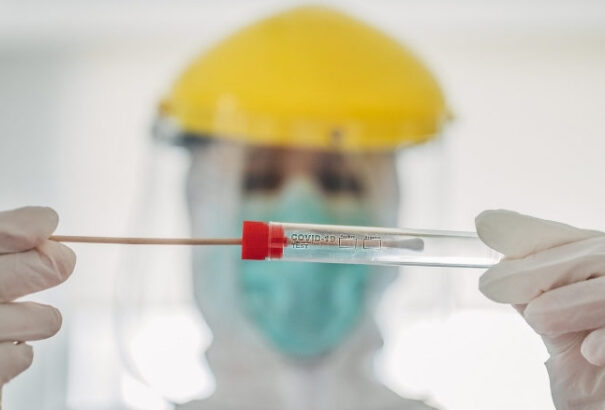 Koronavírus Szlovákiában: 42 új fertőzött és 3 elhunyt az elmúlt nap mérlege