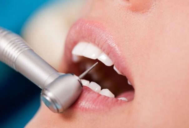 Masszívan visszaesett a fogászati szűrővizsgálaton résztvevők száma