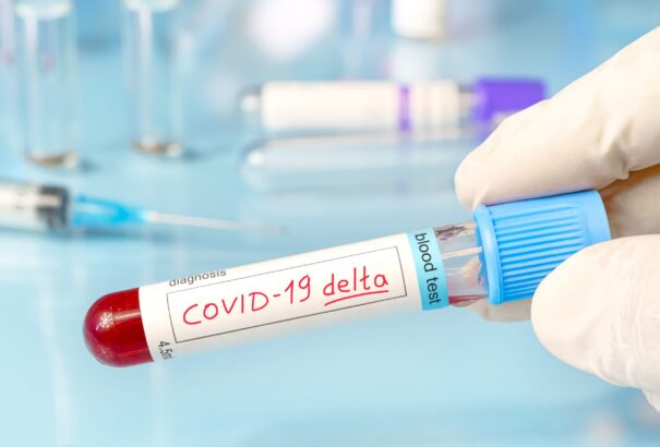 Szlovákiában is igazolták a Delta-variáns fertőzőbb szubvariánsának jelenlétét