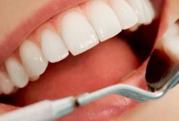 Mi a foghíd és miként készül?