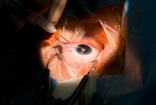 A jó szemét műtötték ki a betegnek az egyik pozsonyi kórházban