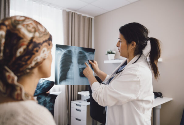 A rákos halálozás okai