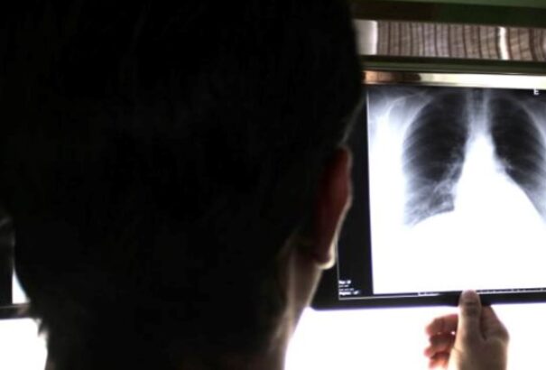 12 daganatot élt túl eddig egy spanyol nő, az orvosok sem értik, hogyan