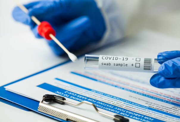 Kínai infektológus: Itt az ideje megváltoztatni a COVID-19 betegség besorolását