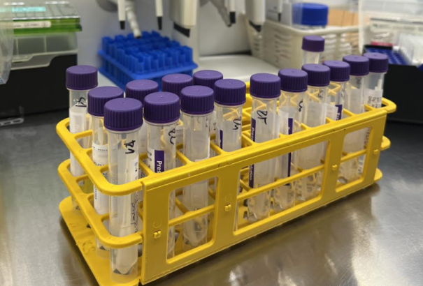 A bélparaziták gyakoribbak, mint gondolnánk