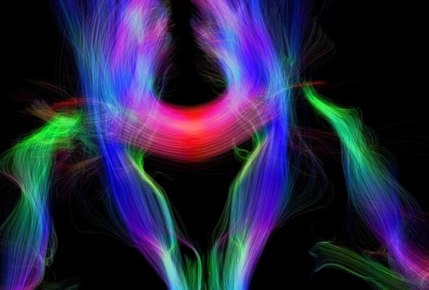 Átalakítja az agyat az idegen nyelv