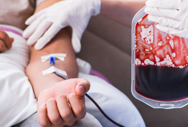 Fogytán vannak az A-, a 0- és az AB Rh-negatív vérkészletek