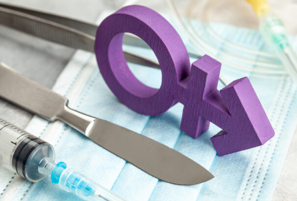 Cseh alkotmánybíróság: A műtét nem feltétele a nemváltás hivatalos elismerésének