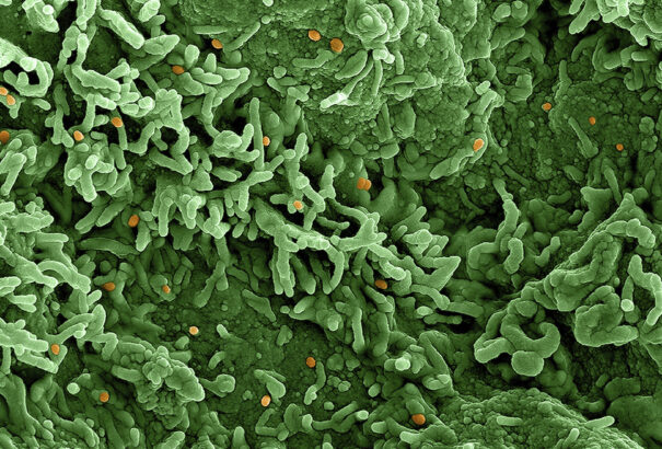 Az ENSZ szerint nincs ok pánikra a majomhimlő európai megjelenés miatt