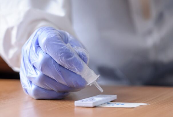 Az infektológus szerint csak egy teszt képes megkülönböztetni a COVID-19-et az influenzától, a tünetek hasonlóak