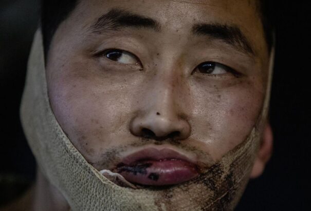 A dél-koreai hírszerzés szerint eddig 300 észak-koreai esett el az ukrán fronton