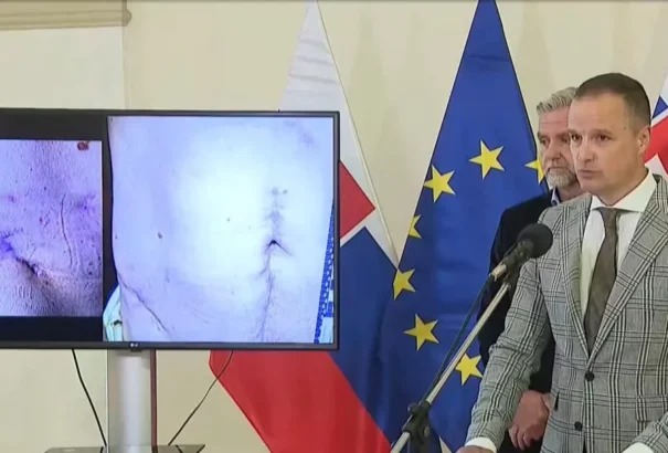 Fico ügyvédje közzétette a miniszterelnök merénylet utáni sérüléseinek felvételeit