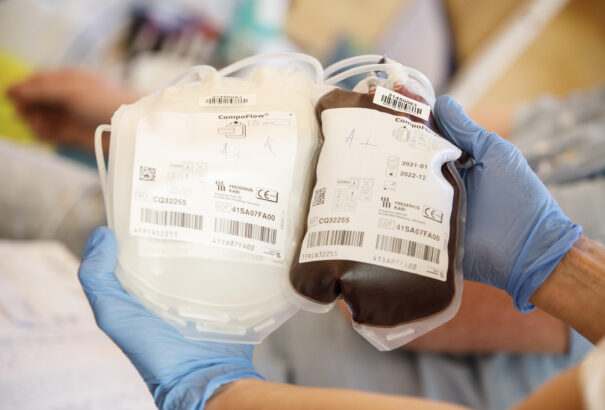 Új vércsoportot fedeztek fel egy karibi nőnél – ő az egyedüli ismert hordozó a világon