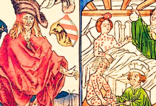 Lepra az Újvilágban már az európaiak előtt is létezett