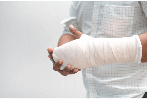 Vezethetünk gépkocsit törött, vagy sérült végtaggal?